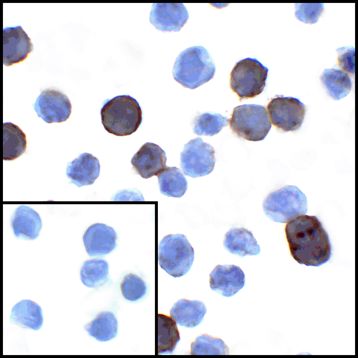 CD274 Antibody