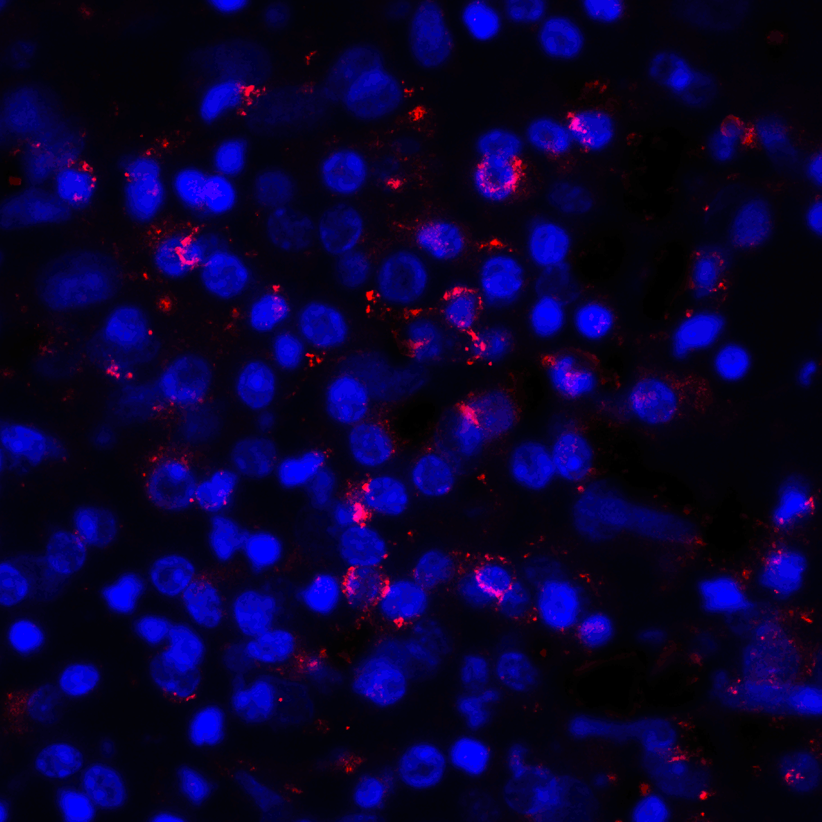 CD274 Antibody