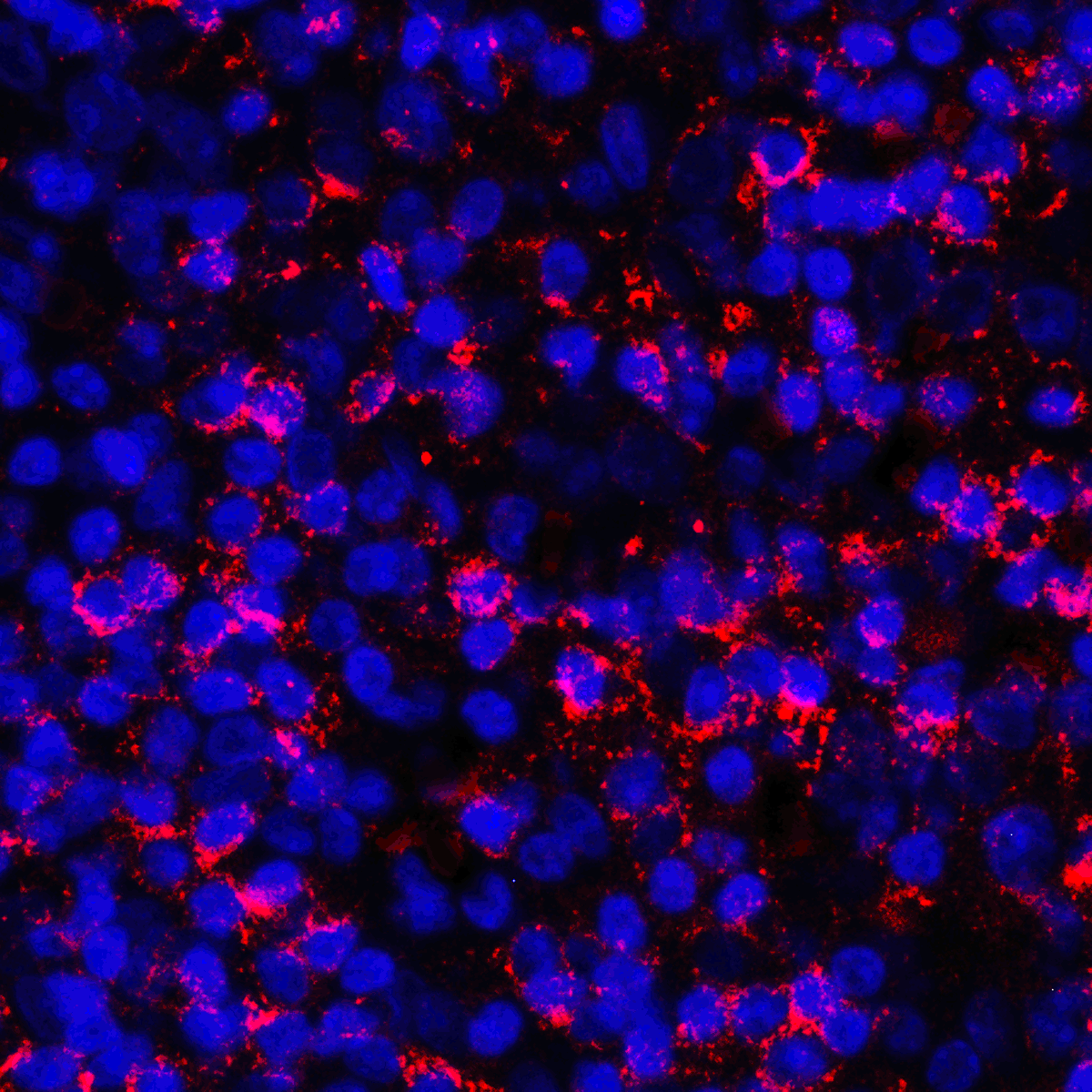 CD274 Antibody