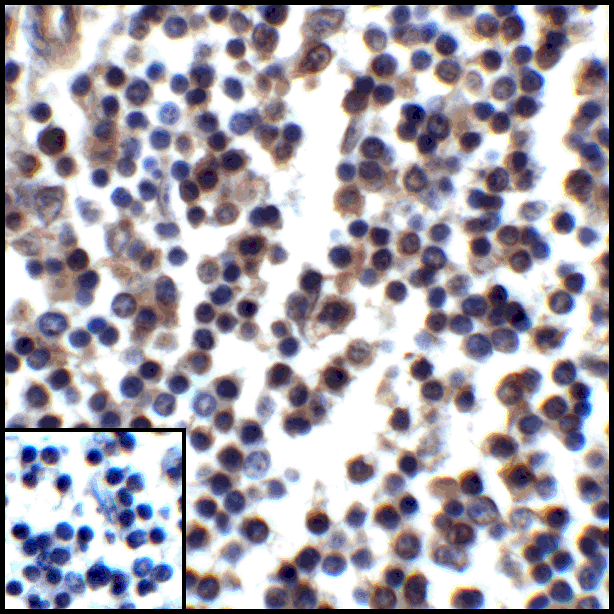 CD274 Antibody