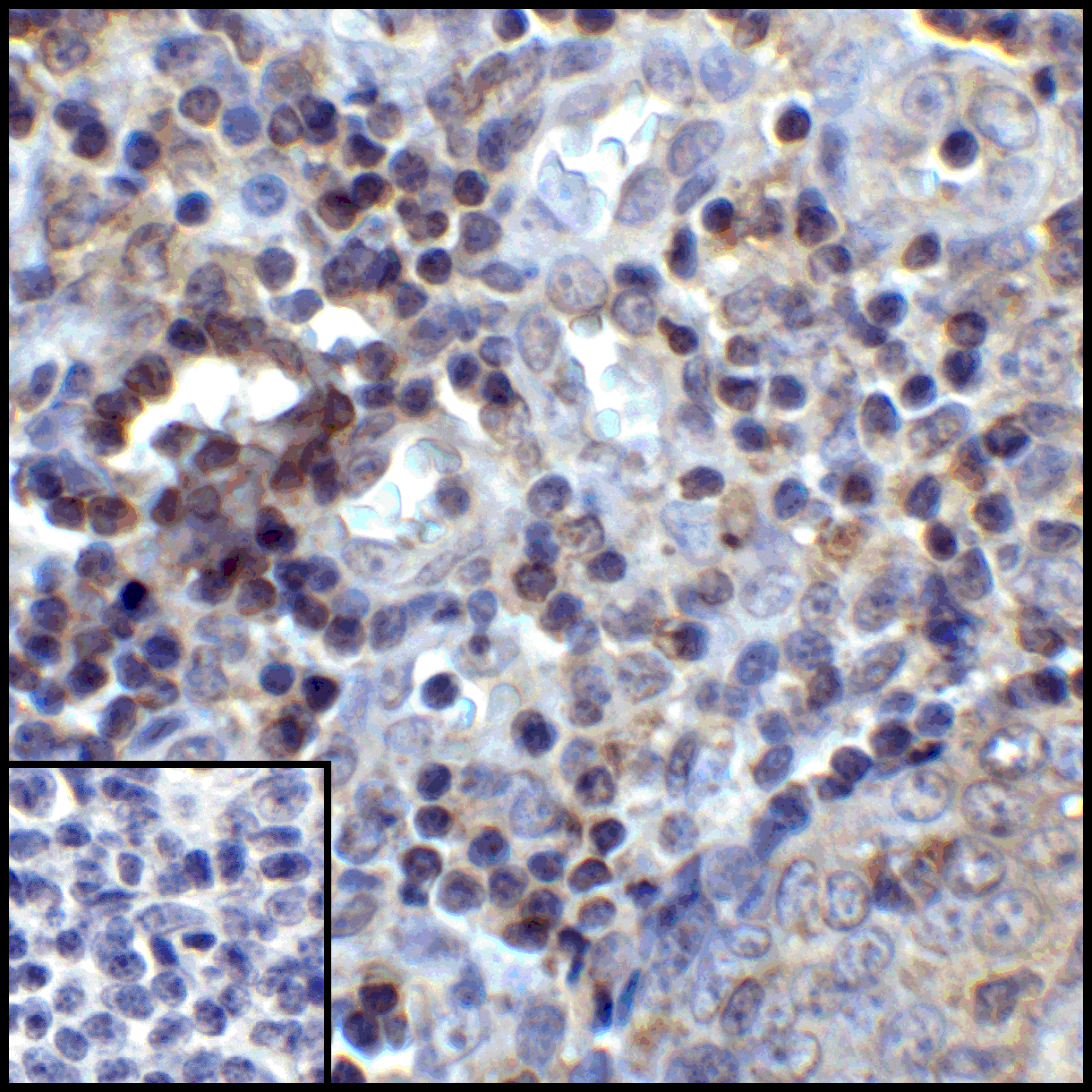 CD274 Antibody