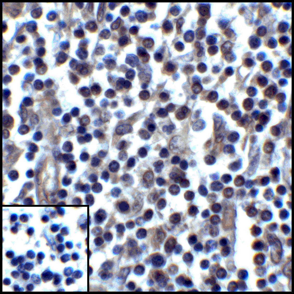 PDL1 Antibody [2D6]