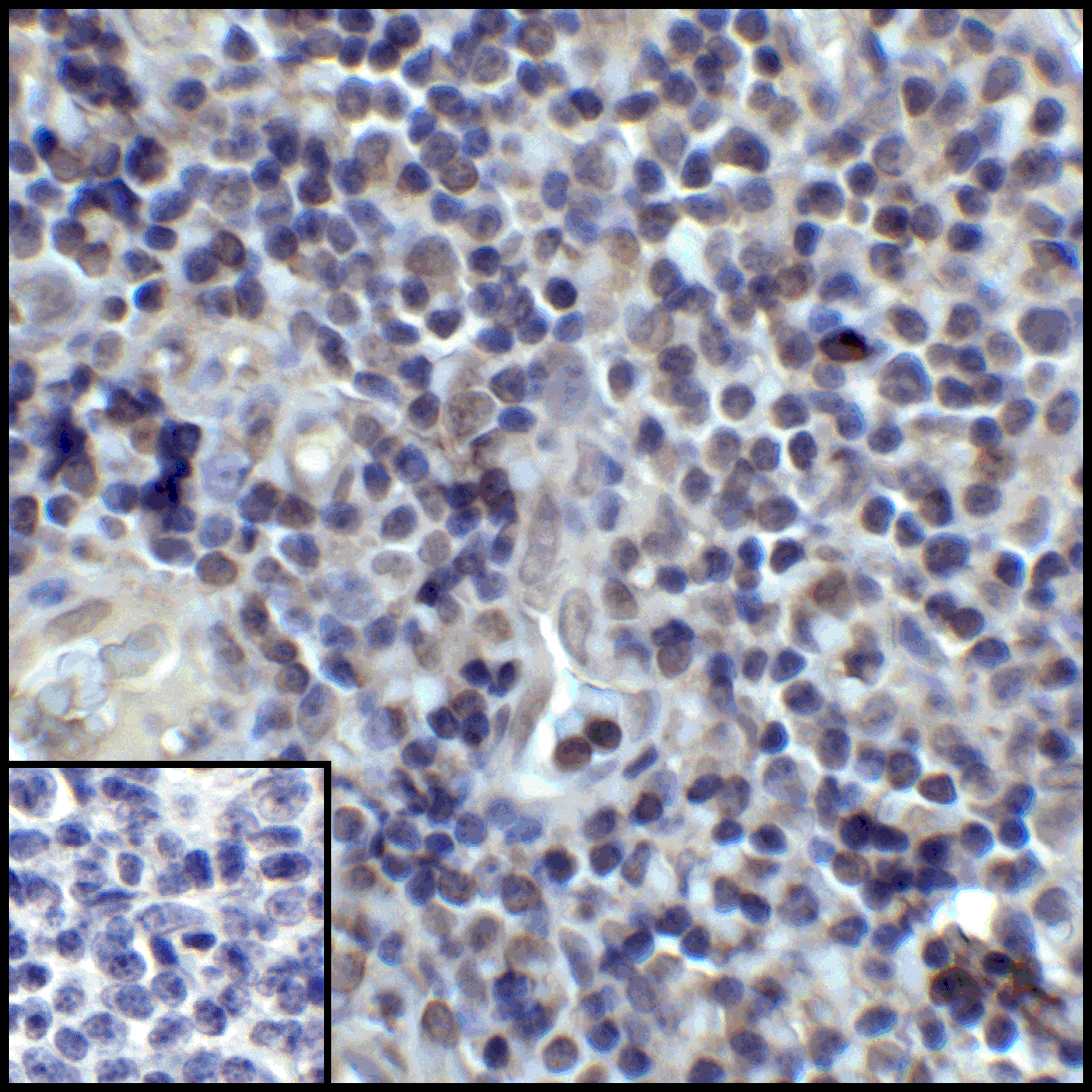 PDL1 Antibody [2D6]