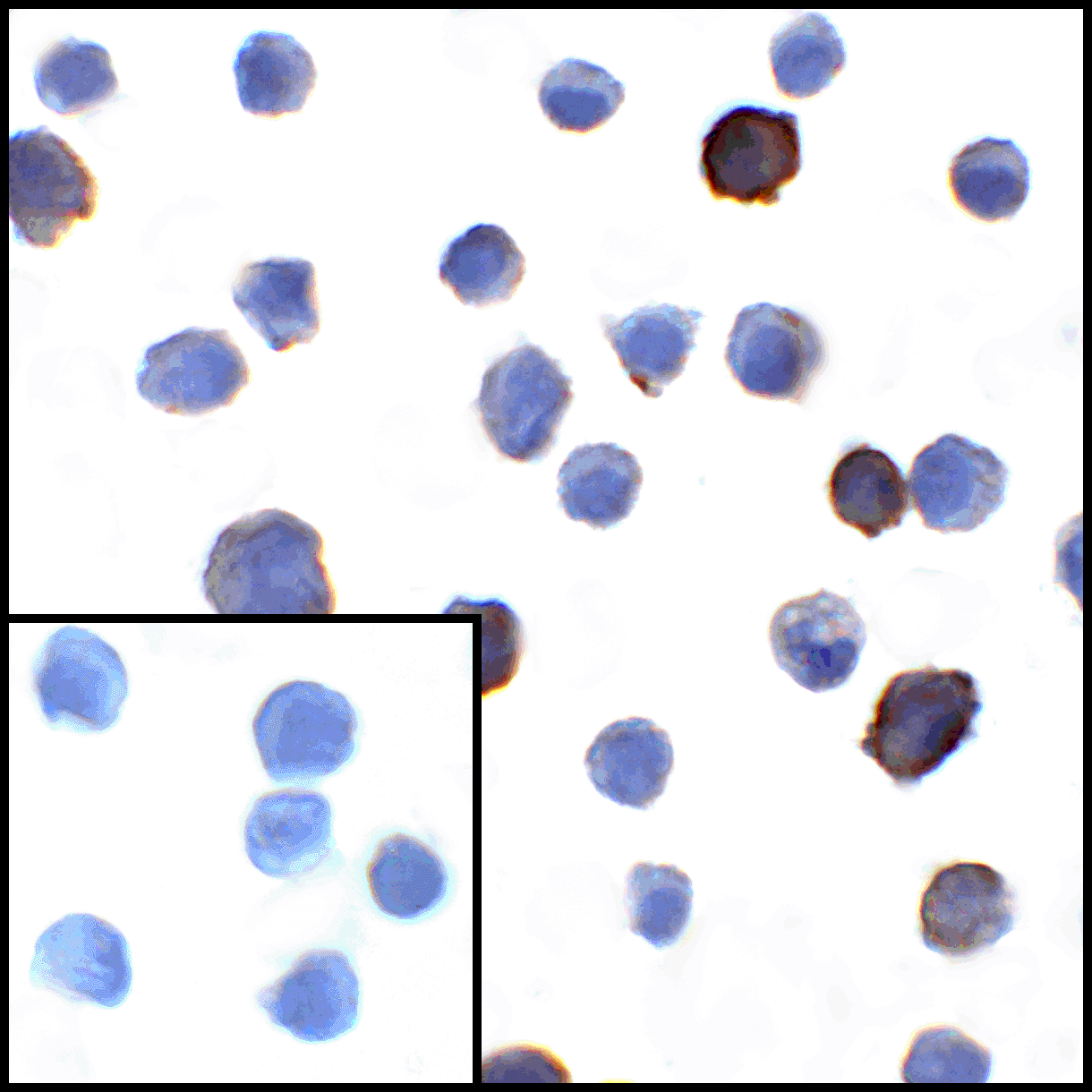PDL1 Antibody [1F11]