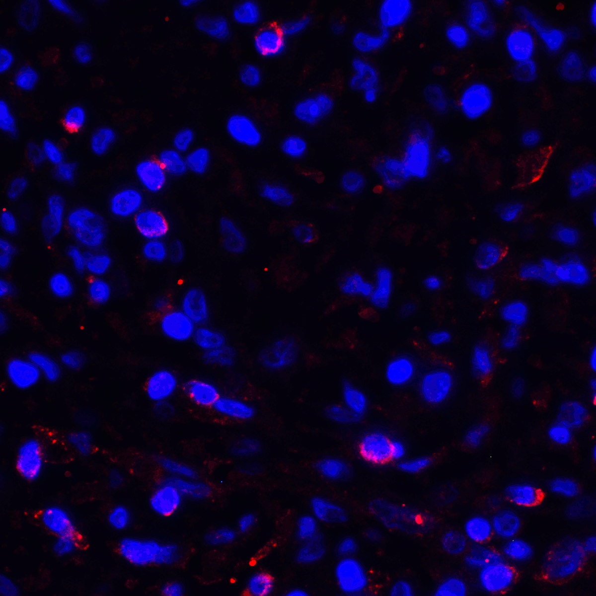 PDL1 Antibody [1F11]