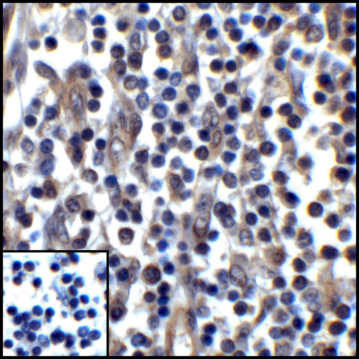 PDL1 Antibody [1F11]