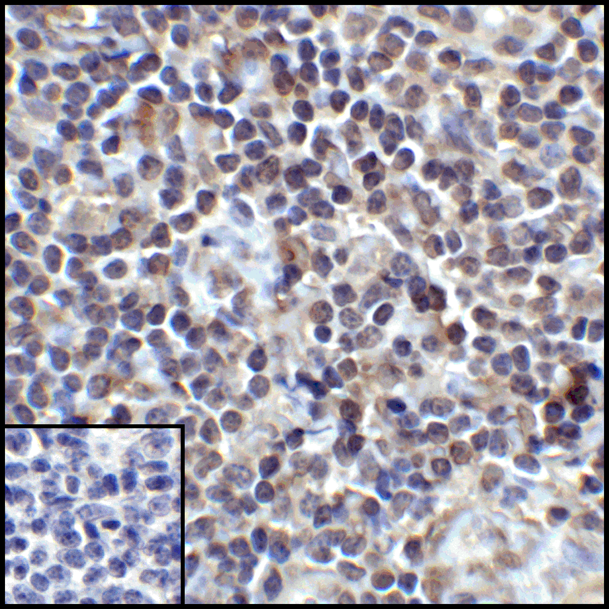 PDL1 Antibody [1F11]
