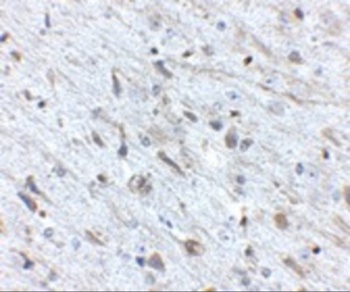 FKBP15 Antibody