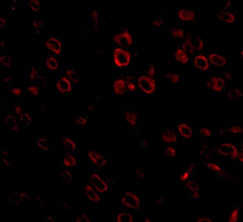 FKBP15 Antibody