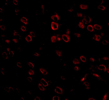 FKBP15 Antibody