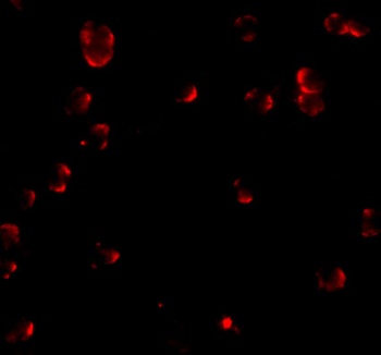 Fibulin 3 Antibody