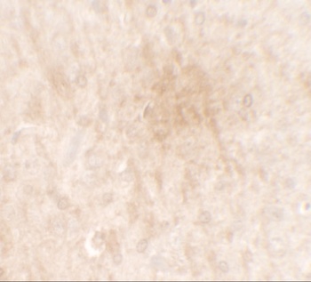 FGFR3 Antibody