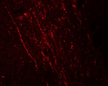 FGFR3 Antibody