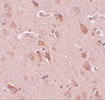 FAM59B Antibody