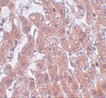 FAM59A Antibody