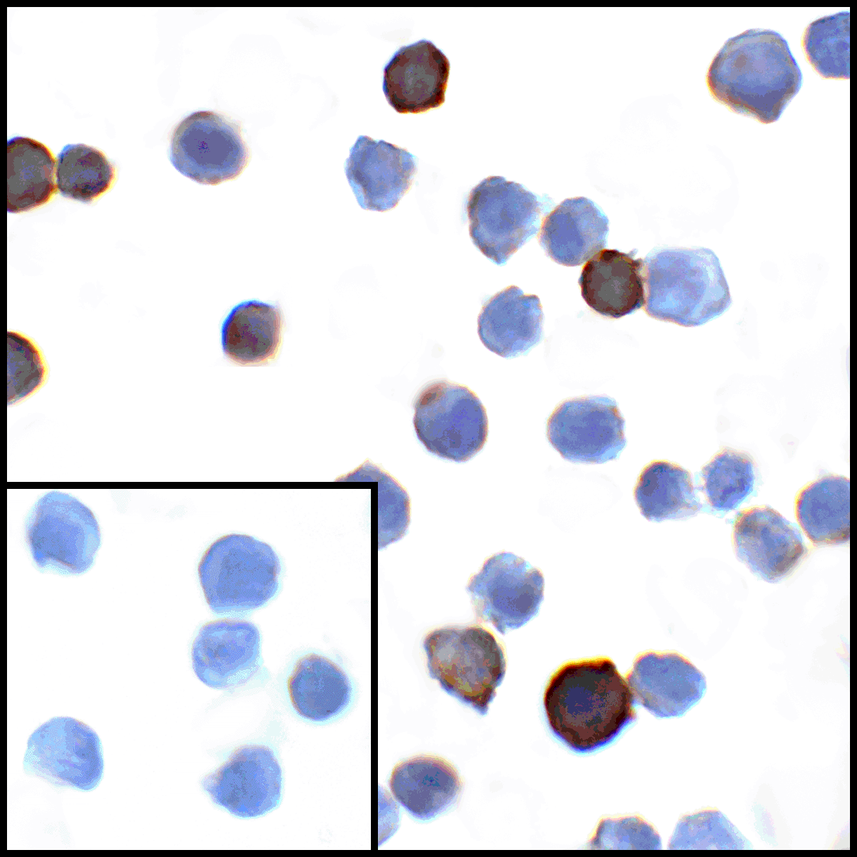 CD274 Antibody