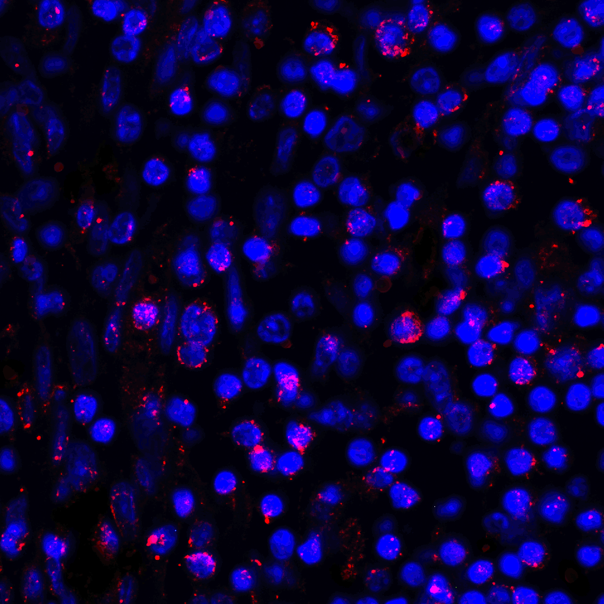 CD274 Antibody