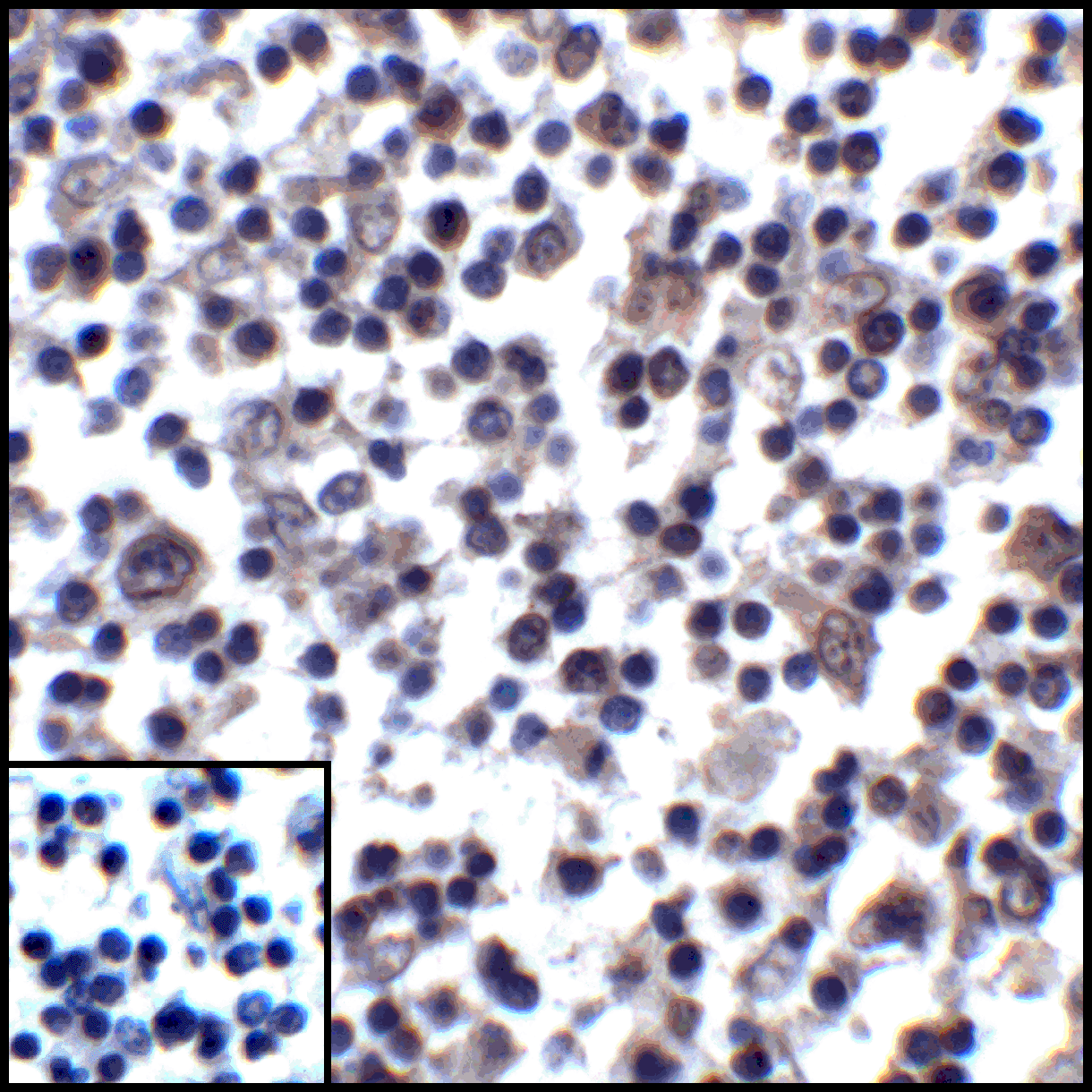 CD274 Antibody