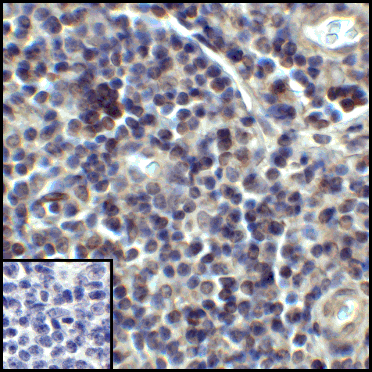 CD274 Antibody