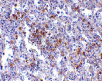 TMC6 Antibody