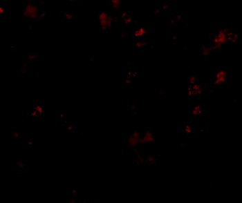 EVER1 Antibody