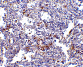 TMC6 Antibody