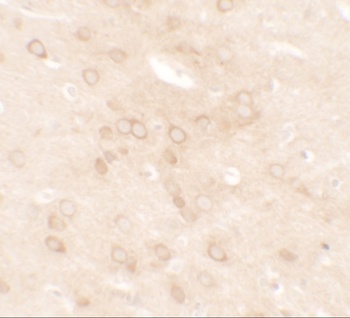 ESR1 Antibody