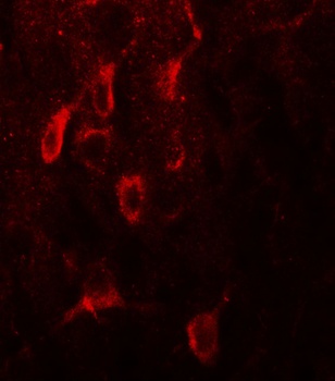 ESR1 Antibody