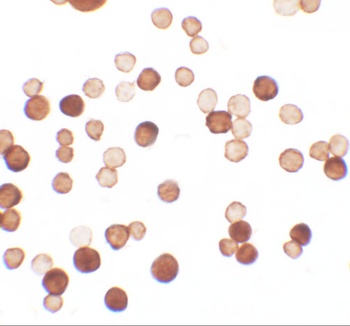 C1orf64 Antibody