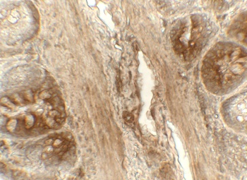 PDIA4 Antibody