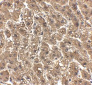 ERBB2 Antibody