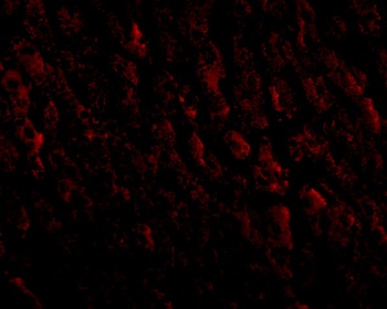 ERBB2 Antibody