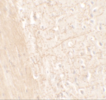 ERAP1 Antibody