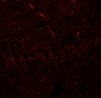 ERAP1 Antibody