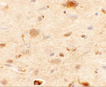 EPAC1 Antibody