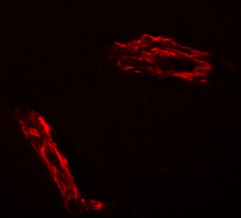 RAPGEF3 Antibody