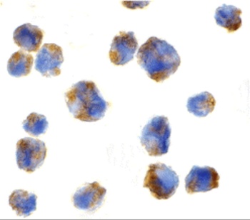 CCL11 Antibody