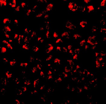 Eotaxin Antibody