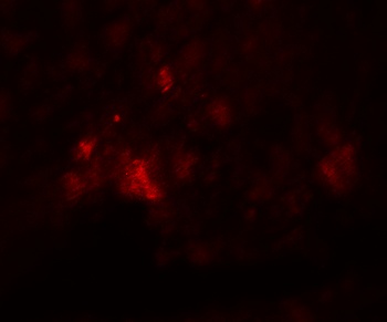 PD-L1 Antibody