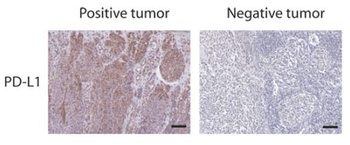 PD-L1 Antibody