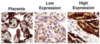 PD-L1 Antibody