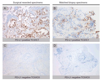 PD-L1 Antibody