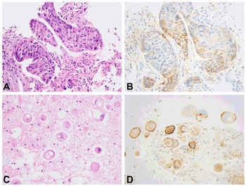 PD-L1 Antibody