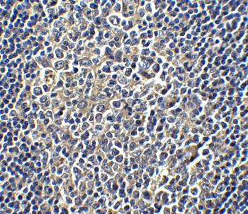 PD-L1 Antibody