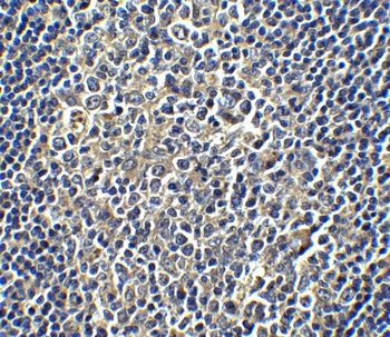 CD274 Antibody