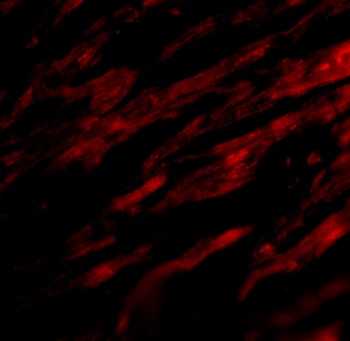 PD-L1 Antibody