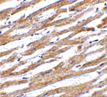 CD274 Antibody