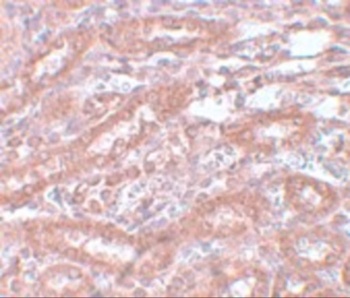 ENC1 Antibody