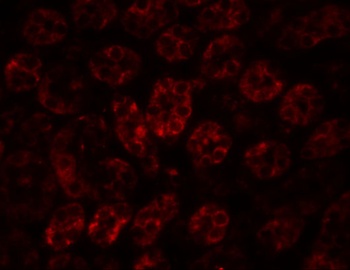 ENC1 Antibody