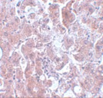 ELOVL7 Antibody